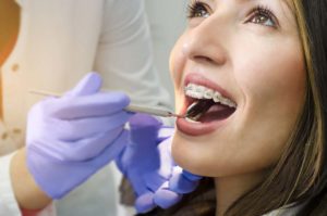 Adult Treatment for Aligning Teeth (Orthodontics)